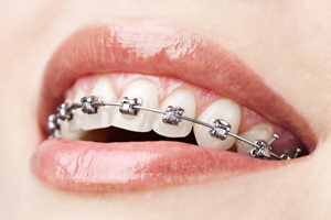 Orthodontics